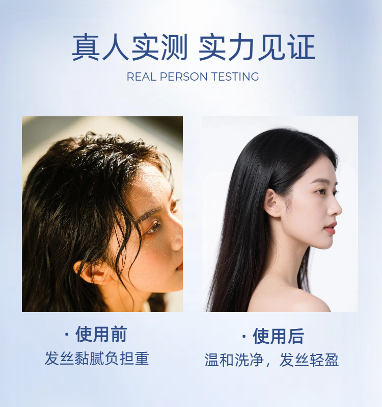 04简约时尚风蓝色美妆护肤类营销带货祛痘精华商品详情页.png